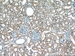 RNF170 Rabbit anti-Human, Polyclonal, Proteintech 150 &mu;L; Unconjugated:Antibodies,