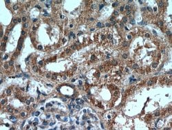 RNF170 Rabbit anti-Human, Polyclonal, Proteintech 150 &mu;L; Unconjugated:Antibodies,