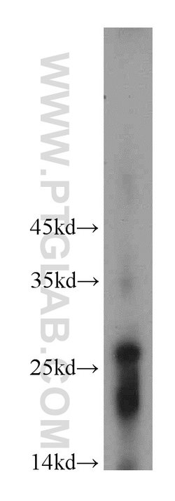 RNF170 Rabbit anti-Human, Polyclonal, Proteintech 150 &mu;L; Unconjugated:Antibodies,