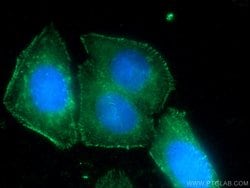 FAM78A Rabbit anti-Human, Mouse, Rat, Polyclonal, Proteintech:Antibodies:Primary