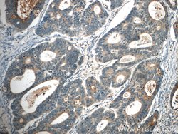 FAM78A Rabbit anti-Human, Mouse, Rat, Polyclonal, Proteintech:Antibodies:Primary