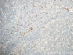 FAM78A Rabbit anti-Human, Mouse, Rat, Polyclonal, Proteintech:Antibodies:Primary
