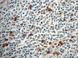 FAM78A Rabbit anti-Human, Mouse, Rat, Polyclonal, Proteintech:Antibodies:Primary