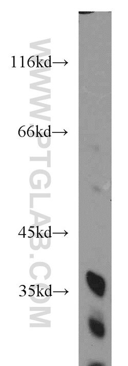 FAM78A Rabbit anti-Human, Mouse, Rat, Polyclonal, Proteintech:Antibodies:Primary