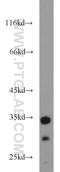 FAM78A Rabbit anti-Human, Mouse, Rat, Polyclonal, Proteintech:Antibodies:Primary