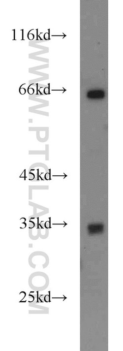 FAM78A Rabbit anti-Human, Mouse, Rat, Polyclonal, Proteintech:Antibodies:Primary