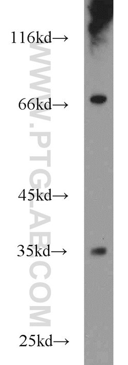 FAM78A Rabbit anti-Human, Mouse, Rat, Polyclonal, Proteintech:Antibodies:Primary
