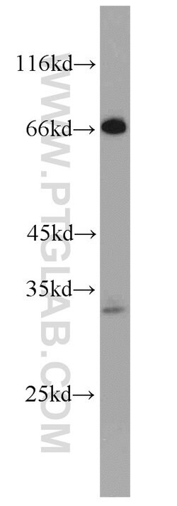 FAM78A Rabbit anti-Human, Mouse, Rat, Polyclonal, Proteintech:Antibodies:Primary