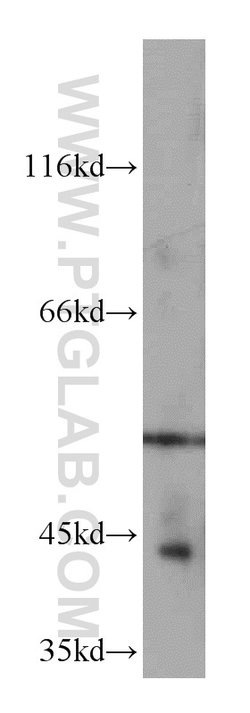NR1I3 Rabbit anti-Human, Mouse, Rat, Polyclonal, Proteintech 150 &mu;L;