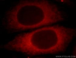 UBXD2 Rabbit anti-Human, Mouse, Rat, Polyclonal, Proteintech 150 &mu;L;