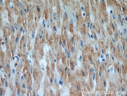 UBXD2 Rabbit anti-Human, Mouse, Rat, Polyclonal, Proteintech 150 &mu;L;