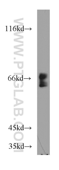 UBXD2 Rabbit anti-Human, Mouse, Rat, Polyclonal, Proteintech 150 &mu;L;