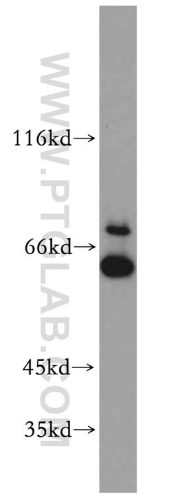 UBXD2 Rabbit anti-Human, Mouse, Rat, Polyclonal, Proteintech 150 &mu;L;