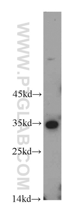 PNO1 Rabbit anti-Human, Mouse, Rat, Polyclonal, Proteintech:Antibodies:Primary