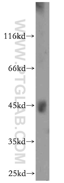 ANKMY2 Rabbit anti-Human, Mouse, Rat, Polyclonal, Proteintech 150 &mu;L;