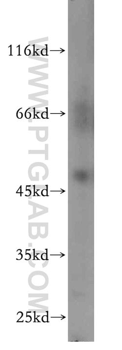 ANKMY2 Rabbit anti-Human, Mouse, Rat, Polyclonal, Proteintech 150 &mu;L;