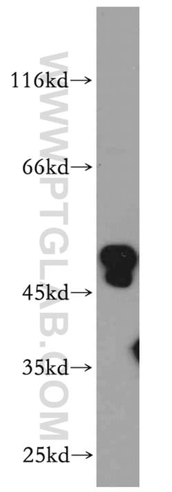 ANKMY2 Rabbit anti-Human, Mouse, Rat, Polyclonal, Proteintech 150 &mu;L;