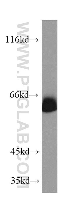 SIM2 Rabbit anti-Human, Mouse, Rat, Polyclonal, Proteintech 150 &mu;L | Buy Online | Proteintech Group Inc | Fisher Scientific