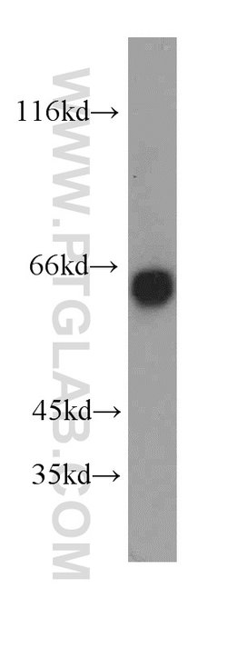 SIM2 Rabbit anti-Human, Mouse, Rat, Polyclonal, Proteintech 150 &mu;L | Buy Online | Proteintech Group Inc | Fisher Scientific