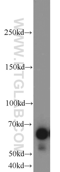 SIM2 Rabbit anti-Human, Mouse, Rat, Polyclonal, Proteintech 150 &mu;L | Buy Online | Proteintech Group Inc | Fisher Scientific