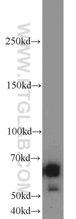 SIM2 Rabbit anti-Human, Mouse, Rat, Polyclonal, Proteintech 150 &mu;L | Buy Online | Proteintech Group Inc | Fisher Scientific
