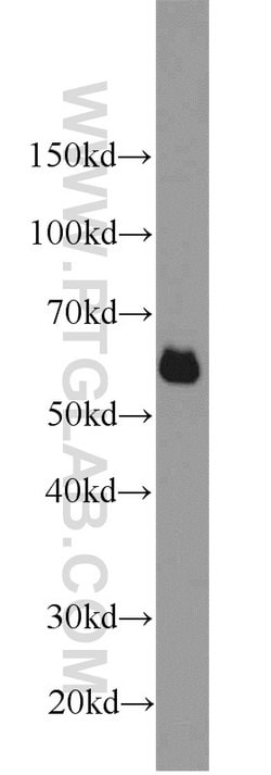 SIM2 Rabbit anti-Human, Mouse, Rat, Polyclonal, Proteintech 150 &mu;L | Buy Online | Proteintech Group Inc | Fisher Scientific