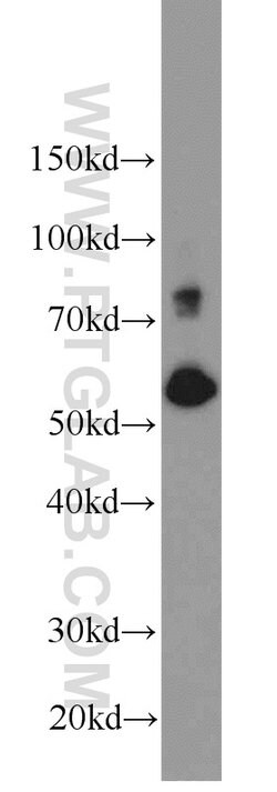 SIM2 Rabbit anti-Human, Mouse, Rat, Polyclonal, Proteintech 150 &mu;L | Buy Online | Proteintech Group Inc | Fisher Scientific