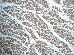 TRIM54 Rabbit anti-Human, Mouse, Rat, Polyclonal, Proteintech 150 &mu;L;