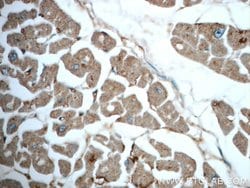 TRIM54 Rabbit anti-Human, Mouse, Rat, Polyclonal, Proteintech 150 &mu;L;