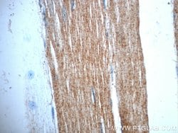 TRIM54 Rabbit anti-Human, Mouse, Rat, Polyclonal, Proteintech 150 &mu;L;