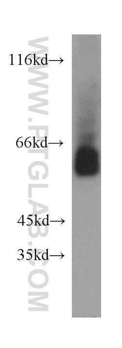 ZNF703 Rabbit anti-Human, Mouse, Rat, Polyclonal, Proteintech 150 &mu;L;