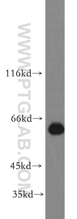 ZNF703 Rabbit anti-Human, Mouse, Rat, Polyclonal, Proteintech 150 &mu;L;