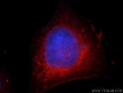 FAM119A Rabbit anti-Human, Mouse, Rat, Polyclonal, Proteintech 150 &mu;L;