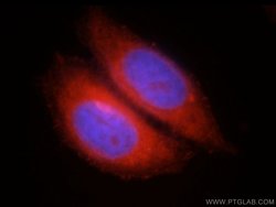 FAM119A Rabbit anti-Human, Mouse, Rat, Polyclonal, Proteintech 150 &mu;L;