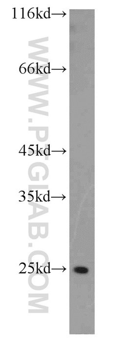 FAM119A Rabbit anti-Human, Mouse, Rat, Polyclonal, Proteintech 150 &mu;L;