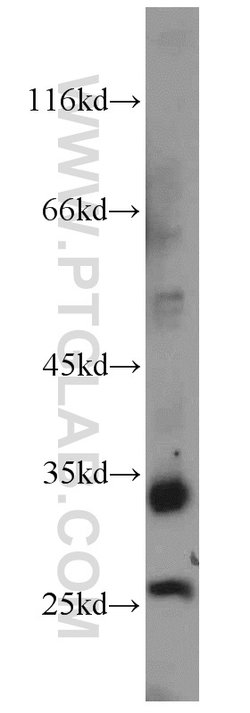 FAM119A Rabbit anti-Human, Mouse, Rat, Polyclonal, Proteintech 150 &mu;L;
