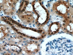 HDDC3 Rabbit anti-Human, Mouse, Rat, Polyclonal, Proteintech 150 &mu;L;
