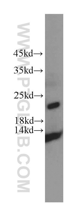 HDDC3 Rabbit anti-Human, Mouse, Rat, Polyclonal, Proteintech 150 &mu;L;
