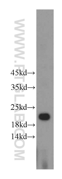 HDDC3 Rabbit anti-Human, Mouse, Rat, Polyclonal, Proteintech 150 &mu;L;