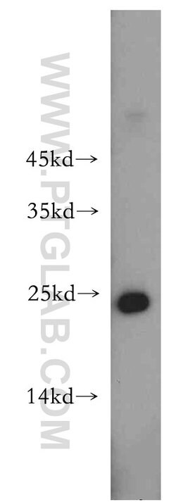 HDDC3 Rabbit anti-Human, Mouse, Rat, Polyclonal, Proteintech 150 &mu;L;