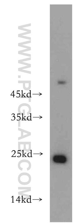 HDDC3 Rabbit anti-Human, Mouse, Rat, Polyclonal, Proteintech 150 &mu;L;