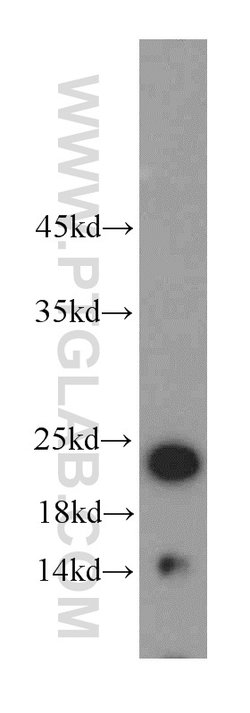 HDDC3 Rabbit anti-Human, Mouse, Rat, Polyclonal, Proteintech 150 &mu;L;