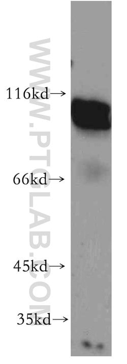 AFAP1 Rabbit anti-Human, Mouse, Rat, Polyclonal, Proteintech 150 &mu;L | Buy Online | Proteintech Group Inc | Fisher Scientific