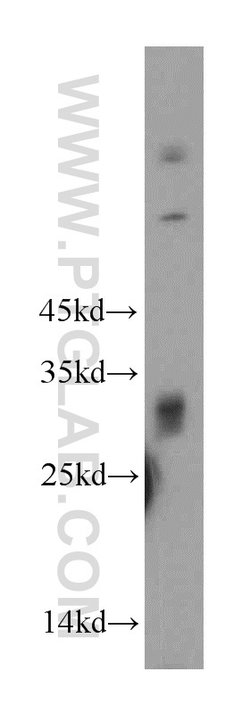 KCTD14 Rabbit anti-Human, Mouse, Polyclonal, Proteintech 150 &mu;L; Unconjugated:Antibodies,