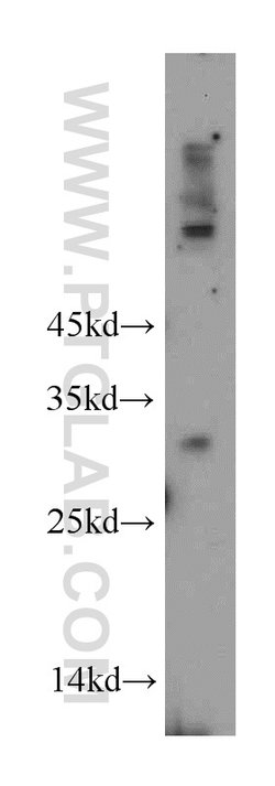 KCTD14 Rabbit anti-Human, Mouse, Polyclonal, Proteintech 150 &mu;L; Unconjugated:Antibodies,