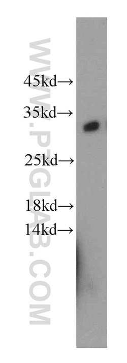 KCTD14 Rabbit anti-Human, Mouse, Polyclonal, Proteintech 150 &mu;L; Unconjugated:Antibodies,