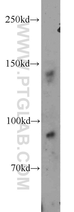 Ceruloplasmin Rabbit anti-Human, Mouse, Polyclonal, Proteintech:Antibodies:Primary
