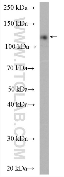 Ceruloplasmin Rabbit anti-Human, Mouse, Polyclonal, Proteintech:Antibodies:Primary