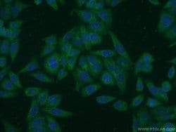 MAN2A1 Rabbit anti-Human, Polyclonal, Proteintech:Antibodies:Primary Antibodies