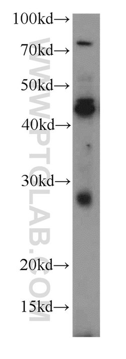 SPACA3 Rabbit anti-Human, Mouse, Rat, Polyclonal, Proteintech:Antibodies:Primary